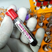 В Казахстане распространяется новый штамм коронавируса 